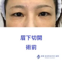 術前
