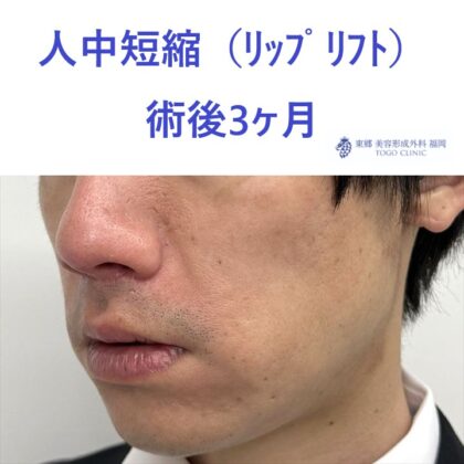 術後 (2)