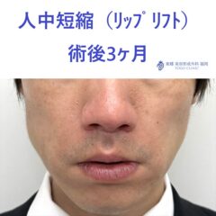 術後