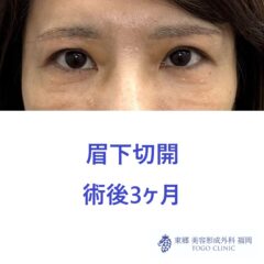 術後