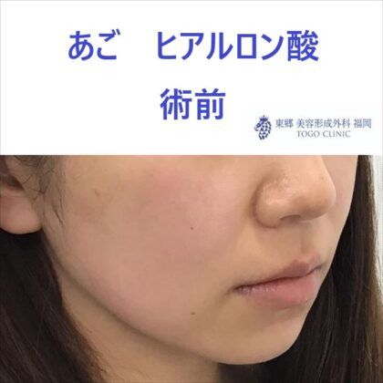 7109bb2fa15f7144f3d52b641d2ed887_R