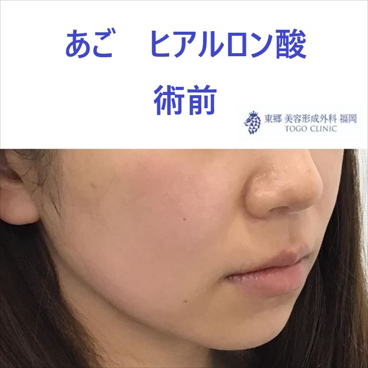 7109bb2fa15f7144f3d52b641d2ed887_R