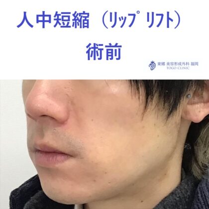 術前 (2)