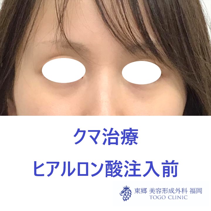 d5c8c85018b6f4cd6b0f0a3481e8cfa2.jpeg