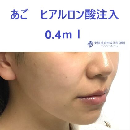 web_176339_R-1.jpeg