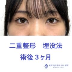 ｻｶﾓﾄｲﾁｶ　3M
