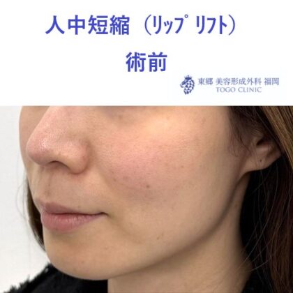 術前 (3)