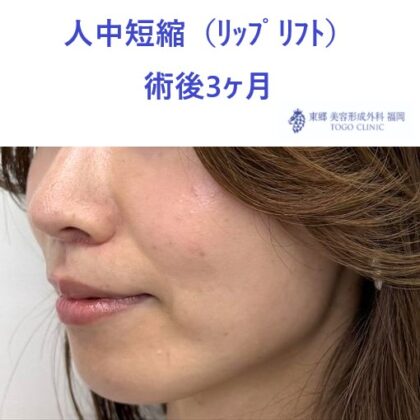 術後 (3)
