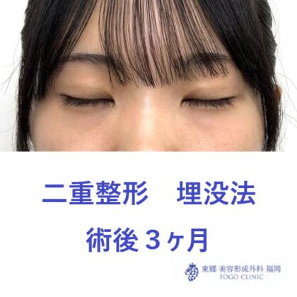 サカモトイチカ 3M