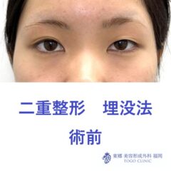 ｻｶﾓﾄｲﾁｶ術前