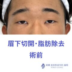 ﾆｼｸﾞﾁｺｳ　術前