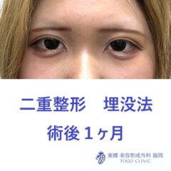 ﾔﾏﾈｷﾞﾅﾂ術後