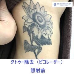 平佐千夏　照射前_R