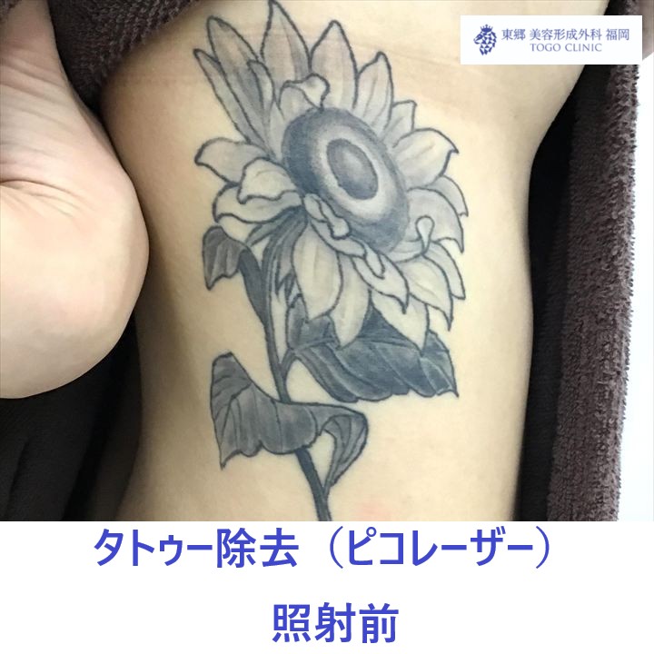 平佐千夏　照射前_R