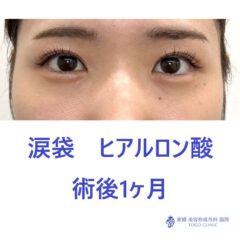 IMG_5132_20250820181949_1_R