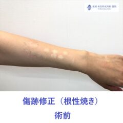 IMG_3353_20250622131818_1_R