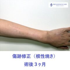 IMG_6087_20250924120725_3_R