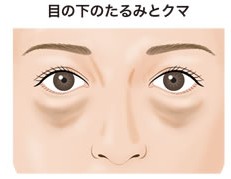 目の下のクマ・シワ一気に改善するなら絶対これ！！