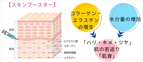 スキンブースターとは