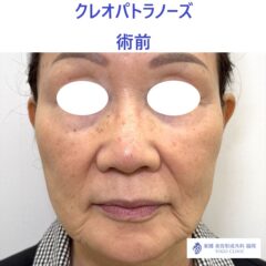 IMG_6435_20251004121745_0_R