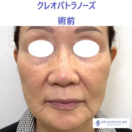 IMG_6435_20251004121745_0_R