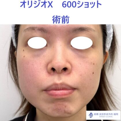 IMG_6831_20251012115806_1_R