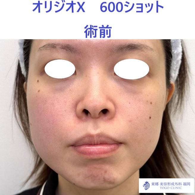 IMG_6831_20251012115806_1_R