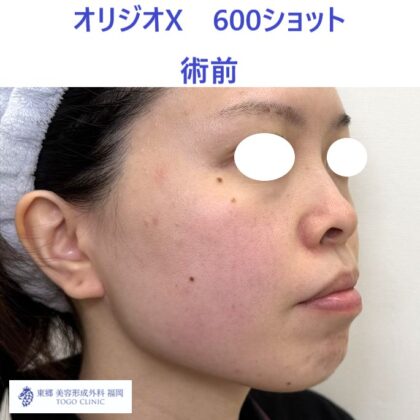 IMG_6837_20251012115813_9_R