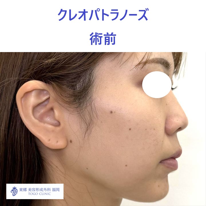 IMG_6865_20251013114334_3_R