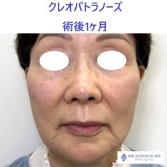 IMG_7912_20251108121346_1_R