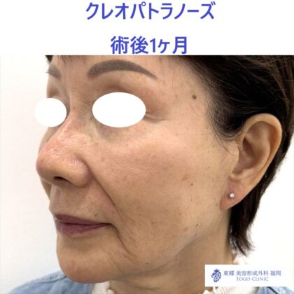 IMG_7924_20251108121418_2_R