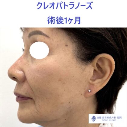 IMG_7925_20251108121419_3_R