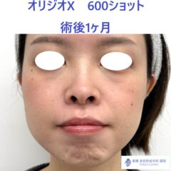 IMG_8673_20251129105120_1_R