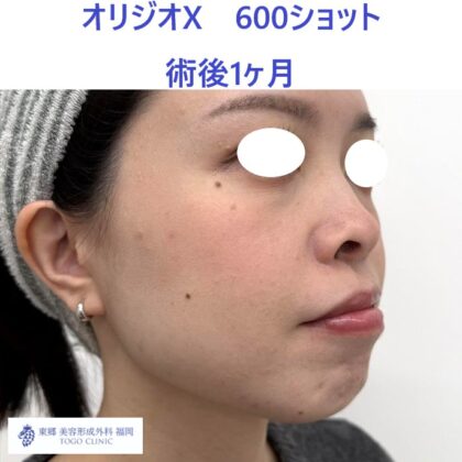 IMG_8678_20251129105125_6_R