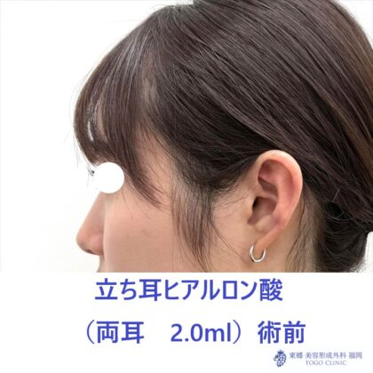 KS　立ち耳術前 (2)_R