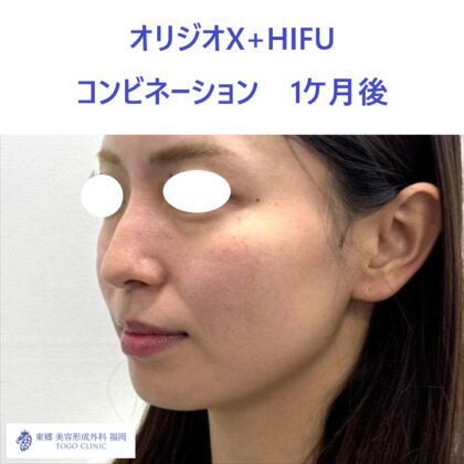 MY　オリジオ術後