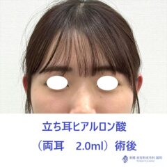 KS 立ち耳術後_R