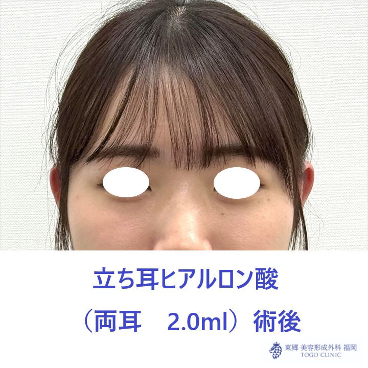 KS　立ち耳術後_R