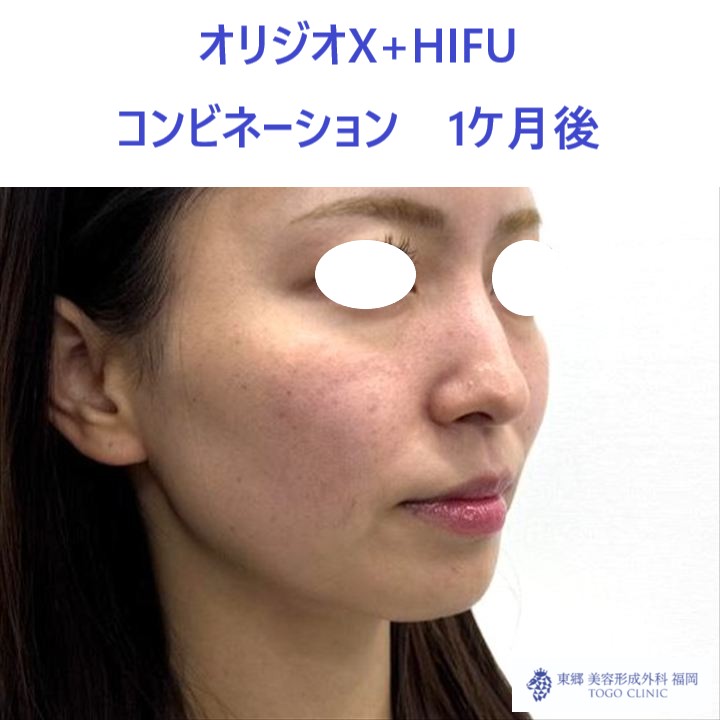 MY　オリジオ術後 (2)