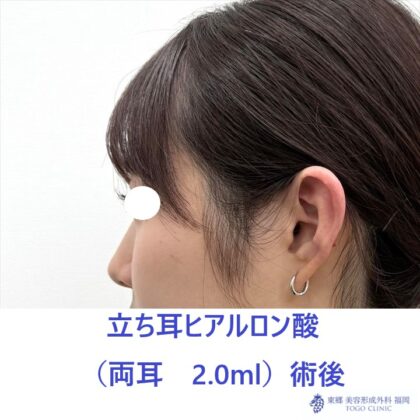 KS　立ち耳術後 (2)_R