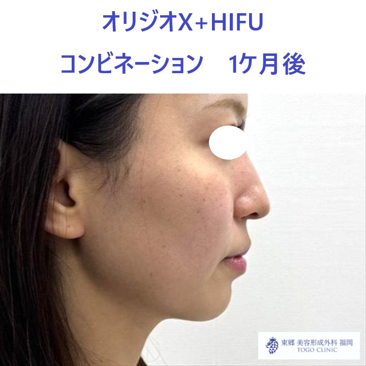 MY　オリジオ術後 (3)