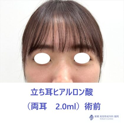 KS　立ち耳術前_R