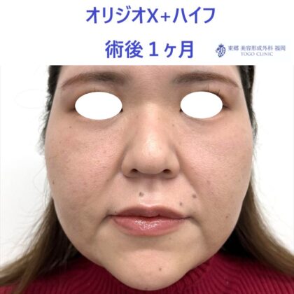 KU　オリジオ術後