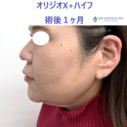 KU　オリジオ術後 (3)