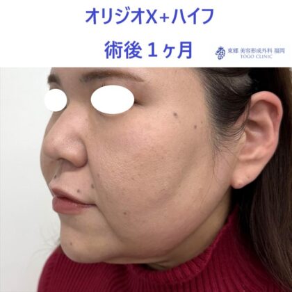 KU　オリジオ術後 (2)