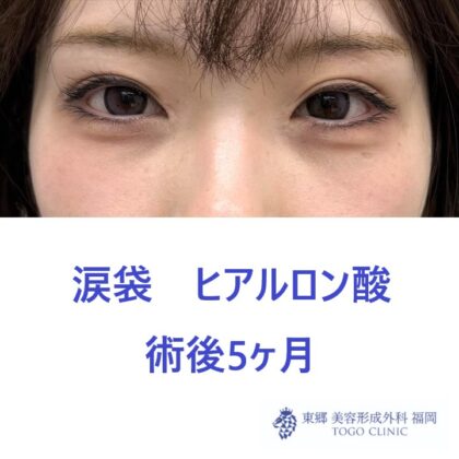 IMG_0445_20260110181920_0_R