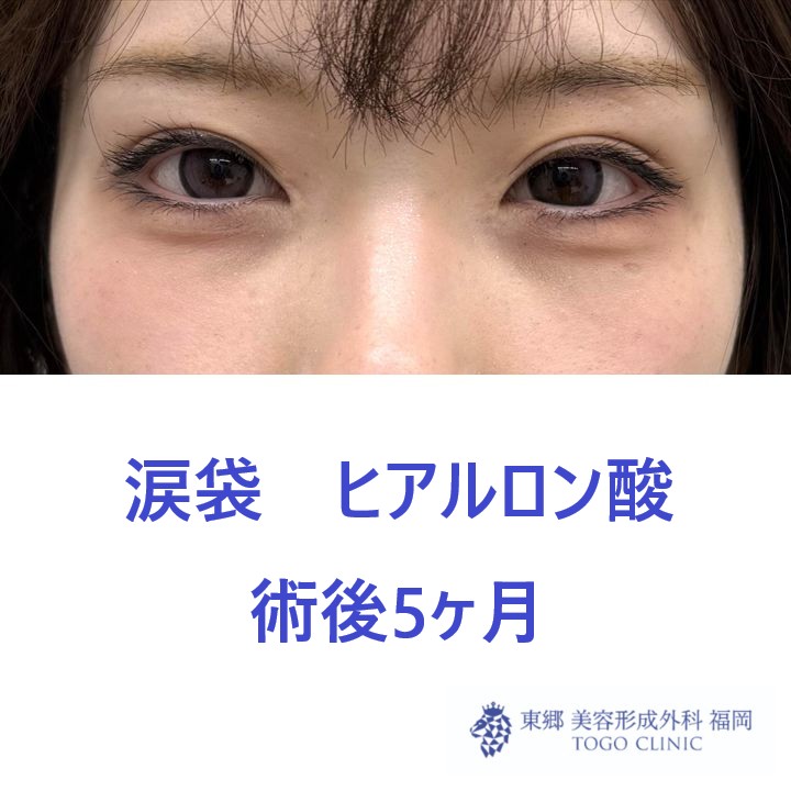 IMG_0445_20260110181920_0_R