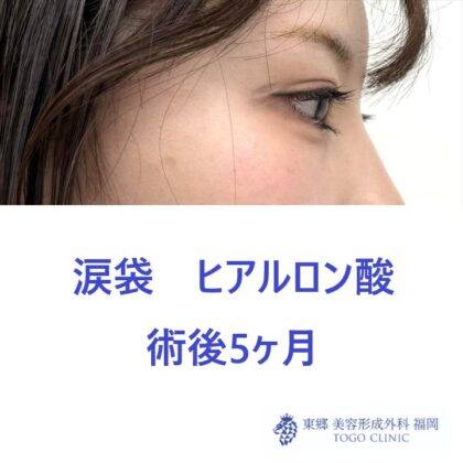 IMG_0447_20260110181922_2_R