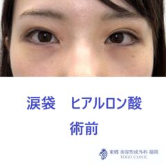 IMG_4888_20250811144432_0_R