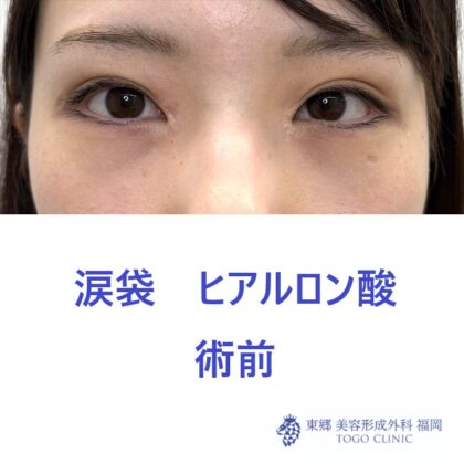 IMG_4888_20250811144432_0_R